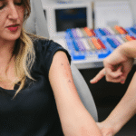allergy testing