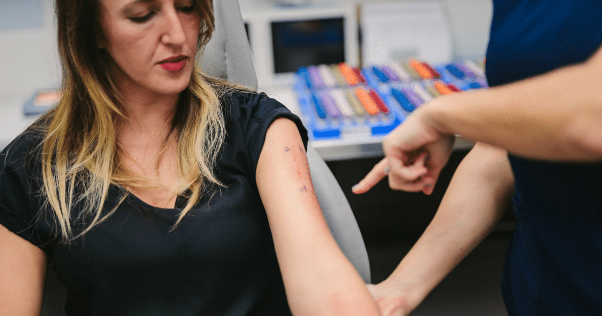 allergy testing