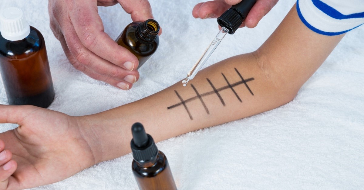 at home allergy test