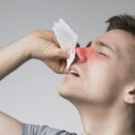 nasal polyps