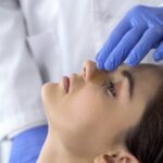 deviated septum causes