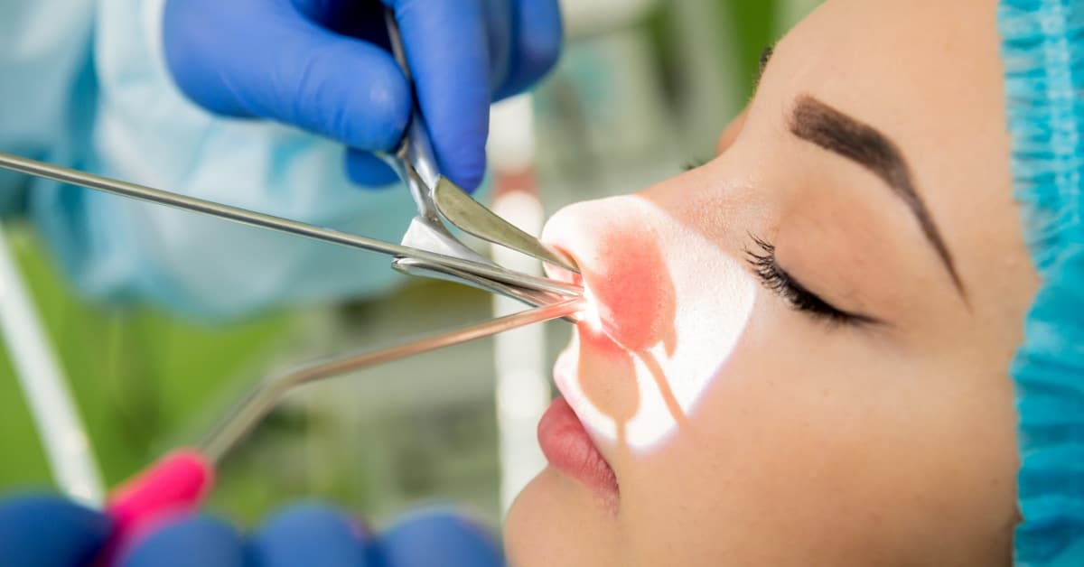vivaer procedure