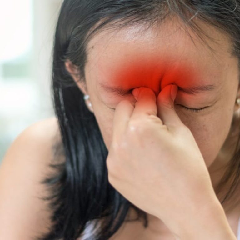 sinus headache
