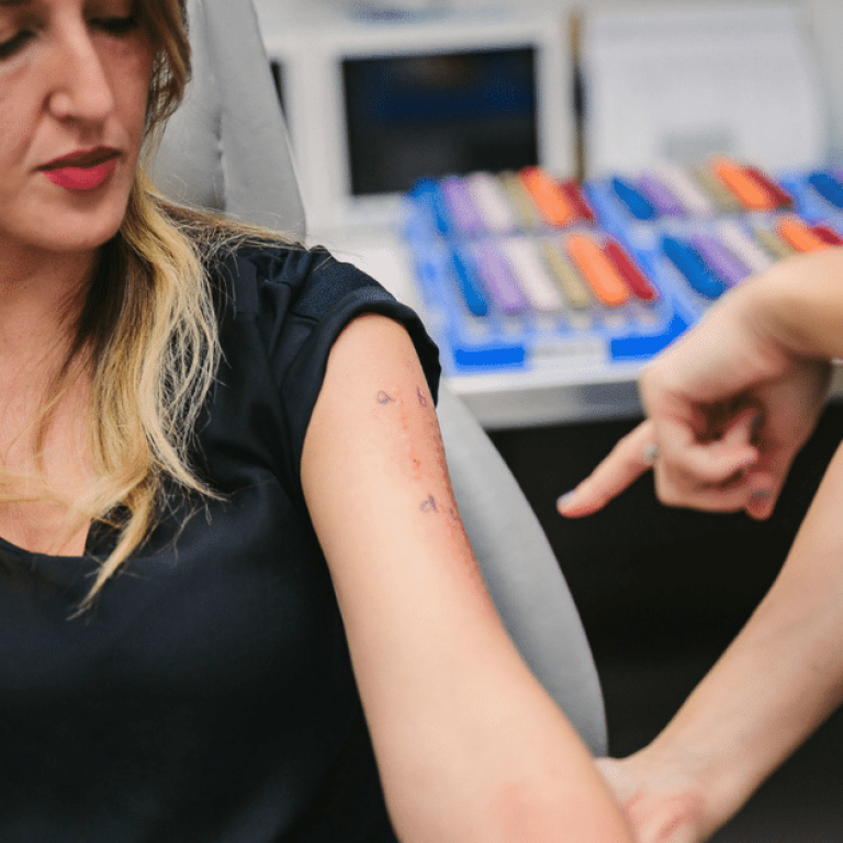 allergy testing