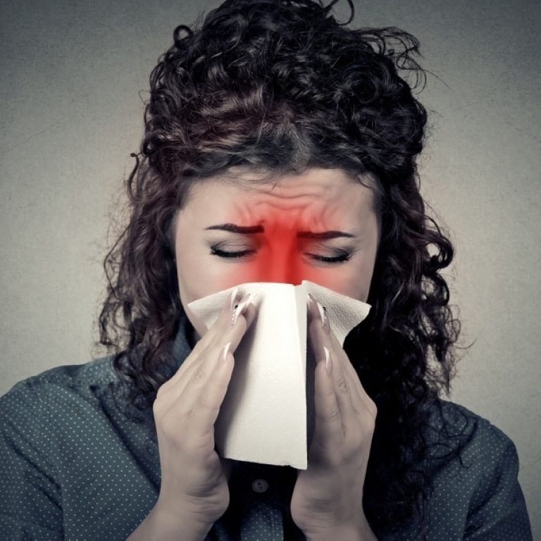 nasal polyps symptoms