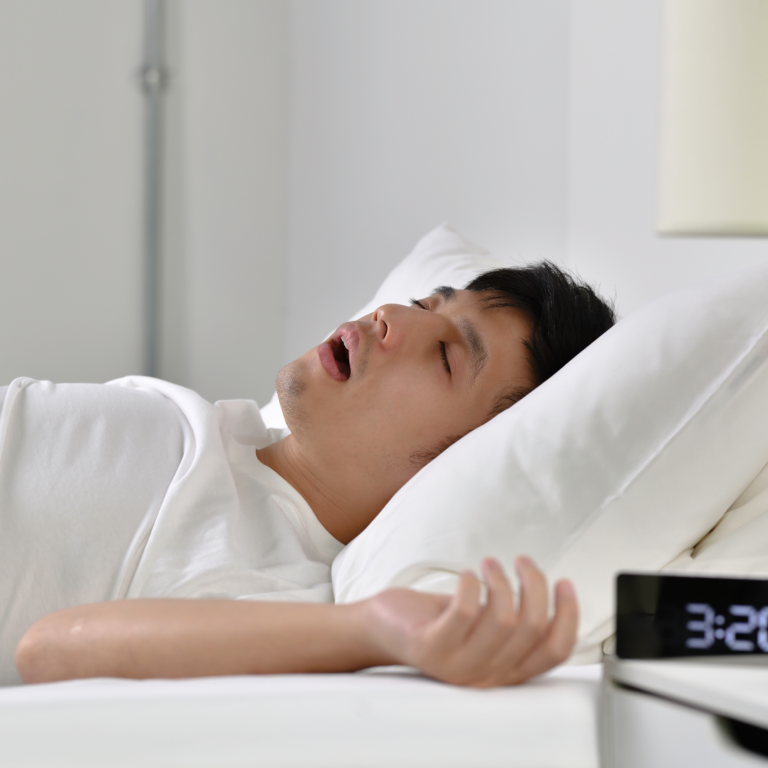 anti snoring nose strips