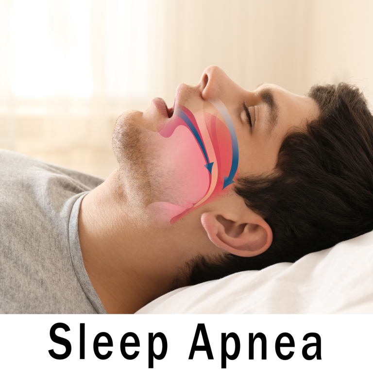 sleep apnea fort lauderdale